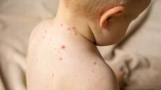 Αμερικανός κυβερνήτης πήγε τα εννέα παιδιά του σε «πάρτι ανεμοβλογιάς» για να κολλήσουν!