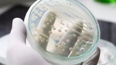 Συναγερμός από το Αμερικανικό Κολέγιο Ιατρών για τον μεταδοτικό και θανατηφόρο μύκητα Candida auris