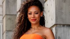 Mel B: Τυφλώθηκα από το δεξί μου μάτι