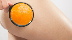 Κυτταρίτιδα: Η ιδανική λύση για το πρόβλημα που ταλαιπωρεί 8 στις 10 γυναίκες