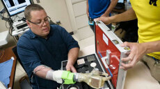 Εξελιγμένο βιονικό χέρι κινείται μόνο με την σκέψη του ασθενούς