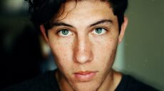 Ακμή: Τα τρόφιμα που δεν πρέπει να τρώμε για να ηρεμήσει το δέρμα