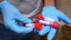 Κορωνοϊός: Θετικά τα 7 από τα 45 δείγματα Σέρβων στο Πευκί Ευβοίας 