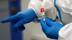 ΗΠΑ: Ασυμπτωματική ηλικιωμένη μετέδιδε τον κορωνοϊό επί 70 ημέρες