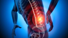 Πόνος στη μέση και τον αυχένα: Οι στοχευμένες θεραπείες που ανακουφίζουν