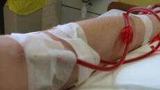 Τραγικό τέλος για 60χρονη στον Πύργο: Tράβηξε κατά λάθος τα καλώδια της αιμοκάθαρσης