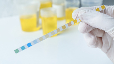 Νέα εποχή για τον καρκίνο ουροθηλίου και νεφρού