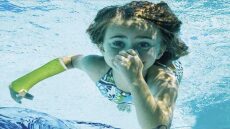 Κάταγμα το καλοκαίρι; Ο αδιάβροχος γύψος AquaCast Liner είναι η λύση