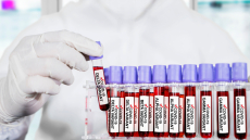 Κορωνοϊός: Πότε διπλασιάζεται ο κίνδυνος σοβαρής Covid-19 και εισαγωγής στο νοσοκομείο