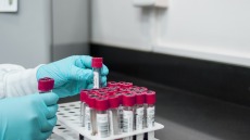 Νέο τεστ αίματος μπορεί να προβλέψει την πιθανότητα σοβαρής νόσησης με Covid-19