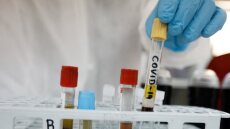 Κορωνοϊός – Ασθενείς: Η βιταμίνη που μειώνει τη φλεγμονή – Πώς συμβάλλει στην ανάρρωση