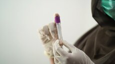 ΠΟΥ: Παγκόσμια συμφωνία για δωρεάν χορήγηση τεστ αντισωμάτων κορωνοϊού σε φτωχές χώρες