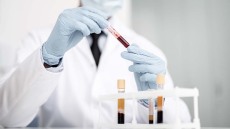 Καρκίνος: Νέο απλό διαγνωστικό τεστ – Εντοπίζει εγκαίρως και τις μεταστάσεις