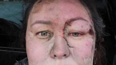 Συγκλονίζει Ουκρανή προπονήτρια κολύμβησης:  «Ήμουν κάτω από τα ερείπια για δύο ώρες, νόμιζα ότι θα πέθαινα θαμμένη ζωντανή»