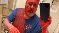 Ρωσία: Επίθεση με μπογιές κατά του νομπελίστα δημοσιογράφου Ντμίτρι Μουράτοφ - «Αυτό είναι για τα αγόρια μας»