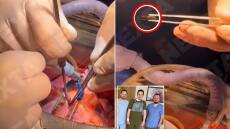 Ουκρανία: Χειρουργοί αφαιρούν σφαίρα από την καρδιά Ουκρανού στρατιώτη