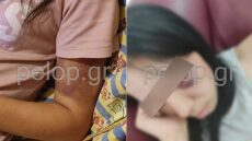 Πάτρα: Θύμα κακοποίησης 16χρονη από τον 25χρονο σύντροφό της - Έκκληση από τη μητέρα της