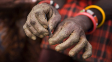 Η φρίκη της κλειτοριδεκτομής - Τουλάχιστον 100 εκατ. γυναίκες την έχουν υποστεί σε 30 χώρες