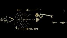 Ινδονησία: Ανακαλύφθηκε η αρχαιότερη ένδειξη ακρωτηριασμού ανθρώπινου ποδιού πριν από... 31.000 χρόνια