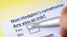 Λέμφωμα μη Hodgkin: Οι θεραπευτικές προσεγγίσεις που αλλάζουν τη ζωή των ασθενών