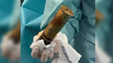 Γαλλία: Εκκενώθηκε νοσοκομείο όταν 88χρονος πήγε στα επείγοντα με... βλήμα στον πρωκτό!