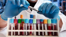 Όρθρος: Η νέα παραλλαγή του κορωνοϊού που εξαπλώνεται ταχύτατα στη Βρετανία 