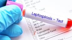 Λεπτοσπείρωση: Τι είναι η μικροβιακή λοίμωξη από την οποία πέθανε ο 57χρονος στη Ζάκυνθο