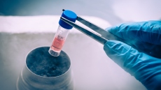 ΕΟΦ: Πώς δεν θα πέσουν οι ασθενείς θύματα εξαπάτησης «για χρήση βλαστοκυττάρων» - Οι συστάσεις