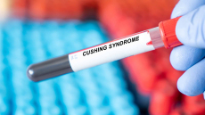 Το σύνδρομο που απειλεί τα οστά και τα αγγεία – Αφορά τους 50ρηδες