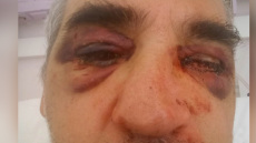 Μύκονος: «Κάποιοι δεν μας γουστάρουν επειδή κάνουμε τη δουλειά μας» είπε ο αρχαιολόγος που ξυλοκοπήθηκε