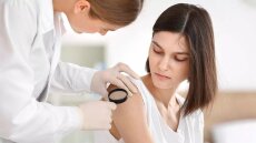 Δέρμα: Όλα όσα πρέπει να γνωρίζουμε για τις ελιές και την αφαίρεσή τους