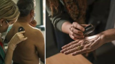 Δωρεάν έλεγχος σπίλων σε 8 ακριτικά νησιά από την La Rοche–Posay και το ΑγκαλιάΖΩ