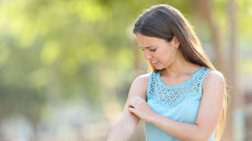 Τσιμπήματα από σφήκα και μέλισσα: Οι πρώτες βοήθειες για τα καλοκαιρινά ατυχήματα