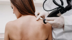 Κρυοχειρουργική: Πότε καλύπτεται από το ασφαλιστήριο η ελάχιστα επεμβατική θεραπεία