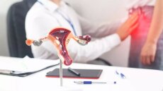 Αφαίρεση ινομυωμάτων: Η λαπαροσκοπική τεχνική που προφυλάσσει από διασπορά της κακοήθειας