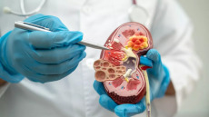 Χρόνια Νεφρική Νόσος: Ανάγκη για πρώιμη διάγνωση και προσυμπτωματικό έλεγχο