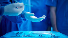 Φλόριντα: Χειρουργός κατηγορείται για ανθρωποκτονία μετά από αφαίρεση λάθος οργάνου σε επέμβαση