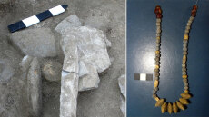 Σύνδρομο Down: Έρευνα εντόπισε την πρώτη γνωστή περίπτωση κατά την αρχαιότητα στην Ελλάδα