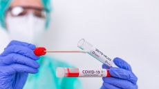 Κορωνοϊός: 27 νεκρούς, 24 διασωληνωμένους και 594 εισαγωγές ανακοίνωσε ο ΕΟΔΥ