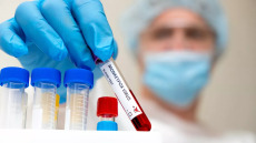 Γερμανία: Περισσότερα κρούσματα mpox έχουν εμφανιστεί στην Ευρώπη από όσα έχουν ανακοινωθεί, λέει ο CEO της Roche