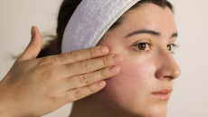 Μελάνωμα: Η «αθώα» δερματική πάθηση που αυξάνει τον κίνδυνο