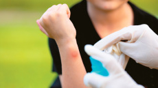 Διαγνώστηκαν τα πρώτα περιστατικά λοίμωξης από τον ιό του Δυτικού Νείλου για φέτος στη χώρα - Τρόποι μετάδοσης και πρόληψης