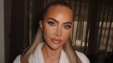 «Δεν αναγνώριζα το πρόσωπό μου»: Ολικό lifting χρειάστηκε μια 34χρονη για να διορθώσει την κατάχρηση fillers