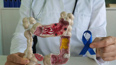 Καρκίνος παχέος εντέρου: 67.000 πολίτες παρέλαβαν το self-test – Πόσα είναι τα θετικά δείγματα