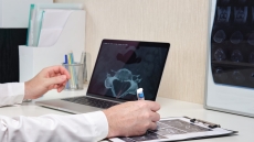 ΕΣΥ: Πόσο σύντομα οι ακτινολόγοι θα κάνουν εξ αποστάσεως διάγνωση σε αξονικές και μαγνητικές τομογραφίες