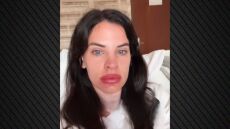 Αγγειοοίδημα είναι η διάγνωση αλλεργιολόγου για τα πρησμένα χείλη της Χριστίνας Μπόμπα