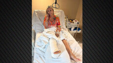 Στο νοσοκομείο με κάταγμα στο πόδι η Ζέττα Μακρή - Η φωτογραφία που ανέβασε από το νοσοκομείο