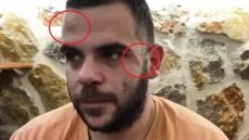 Ο Youtuber Teosty για τον ξυλοδαρμό του στα Γιάννενα: Δεν φοβήθηκα, δείχνω τα σημάδια για να καταλάβουμε ότι η βία είναι πραγματική