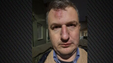 Θύμα ξυλοδαρμού έπεσε εκδότης τοπικής εφημερίδας στον Βόλο