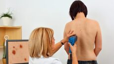 Ασφαλιστήριο – Αποζημίωση: Οι καλύψεις για το μελάνωμα